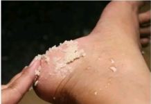 GENIJALAN RECEPT ZA GRUBE RUKE, ISPUCALE PETE, KURJE OČI I KRIVE NOKTE NA NOGAMA: