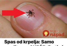 Spas od krpelja: Samo uradite ovo i NEĆE dirati ni vas ni vašeg psa + savjet kako da ih izbacite iz vašeg dvorišta!