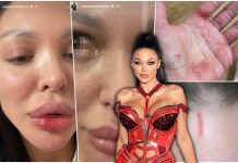 PRETUČENA MAJA MARINKOVIĆ! Objavila uznemirujuće fotografije: Pokazala jezive podlive i rane