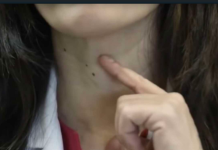 Ako imate problema sa štitnjačom, savjetuje se izbaciti ove dvije specifične namirnice iz prehrane jer ih štitnjača ne prihvaća dobro.