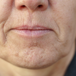 Simptom DEMENCIJE koji se javlja u ustima: Ako ga osjetite, obratite se ljekaru!