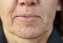 Simptom DEMENCIJE koji se javlja u ustima: Ako ga osjetite, obratite se ljekaru!