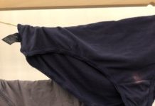 Imate li problema sa ovim mrljama?