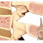 Čaj koji čini kosti neuništitvima : PITI 1šalicu dnevno!