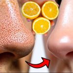12 ČUDESNIH BEAUTY MOĆI LIMUNA 🍋 – Prirodni recepti za savršeno blistavu kožu