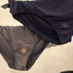 Imate li problema sa ovim mrljama?