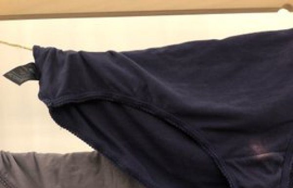 Imate li problema sa ovim mrljama?