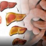 DORUČAK ZA OPORAVAK JETRE: Jede se 2 puta sedmično, obnavlja svaku ćeliju u tijelu! (RECEPT)