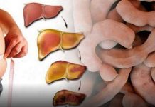 DORUČAK ZA OPORAVAK JETRE: Jede se 2 puta sedmično, obnavlja svaku ćeliju u tijelu! (RECEPT)