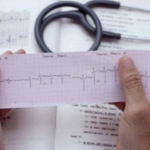 KOJA RUKA BOLI PRED INFARKT: Srčani udar najavljuje ovaj rani simptom, spriječite to