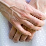 VENE SU VAM ISPUPČENE? 8 razloga zašto se to događa I KADA TREBATE POTRAŽITI DOKTORA!