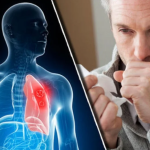 Nikad više nećete dobiti bronhitis i kašalj: Prirodni lek za decu i odrasle