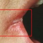 OPASNO PO ŽIVOT: Imate li neki od OVIH simptoma? Nagovještavaju nešto loše!