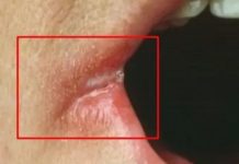 OPASNO PO ŽIVOT: Imate li neki od OVIH simptoma? Nagovještavaju nešto loše!