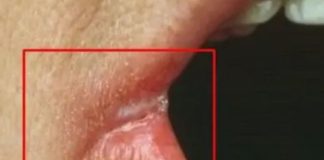 OPASNO PO ŽIVOT: Imate li neki od OVIH simptoma? Nagovještavaju nešto loše!