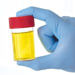 ZAŠTO IMATE JAK I NEPRIJATAN MIRIS URINA: Ovaj znak organizma ne smijete zanemariti! EVO NA ŠTA VAS UPOZORAVA