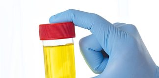 ZAŠTO IMATE JAK I NEPRIJATAN MIRIS URINA: Ovaj znak organizma ne smijete zanemariti! EVO NA ŠTA VAS UPOZORAVA