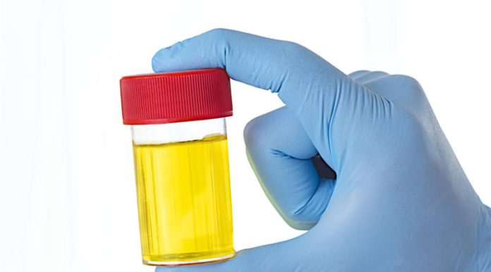 ZAŠTO IMATE JAK I NEPRIJATAN MIRIS URINA: Ovaj znak organizma ne smijete zanemariti! EVO NA ŠTA VAS UPOZORAVA