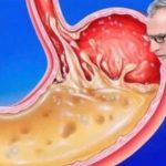 OVO JEDITE ZA VEČERU 3 DANA ZAREDOM: Nećete vjerovati šta će izaći iz vašeg stomaka