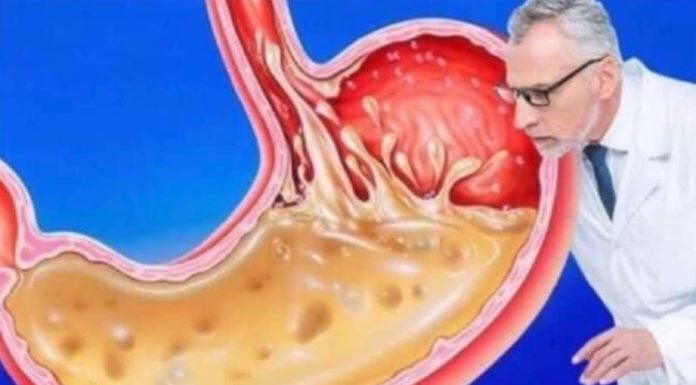 OVO JEDITE ZA VEČERU 3 DANA ZAREDOM: Nećete vjerovati šta će izaći iz vašeg stomaka