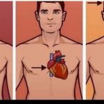 1 ZNAK NA KOŽI UKAZUJE DA JE VAŠE SRCE U LOŠEM STANJU: Ako ovo primijetite javite se doktoru ODMAH!