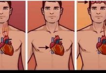 1 ZNAK NA KOŽI UKAZUJE DA JE VAŠE SRCE U LOŠEM STANJU: Ako ovo primijetite javite se doktoru ODMAH!