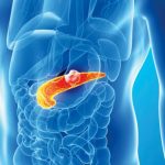 2 podmukle bolesti koje ugrožavaju zdravlje gušterače! Upoznajte ih prije nego što bude prekasno, SAVJETUJE D0KTOR I 0PISUJE SIMPT0ME