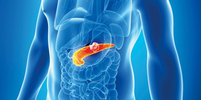 2 podmukle bolesti koje ugrožavaju zdravlje gušterače! Upoznajte ih prije nego što bude prekasno, SAVJETUJE D0KTOR I 0PISUJE SIMPT0ME