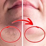 SVAKA ŽENA ZASLUŽUJE DA OVO ZNA: Prirodnim putem uklonite brkove i druge neželjene dlačice sa tijela zauvijek