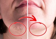 SVAKA ŽENA ZASLUŽUJE DA OVO ZNA: Prirodnim putem uklonite brkove i druge neželjene dlačice sa tijela zauvijek