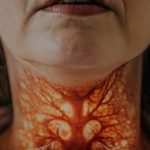 Ako imate problema sa štitnjačom, OVO vam je najveći neprijatelj: Ovu grešku pravi 8 od 10 ljudi sa štitnjačom