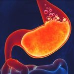 Ova hrana je najveći neprijatelj za želudac – Evo koje namirnice ne smijete jesti pred spavanje!