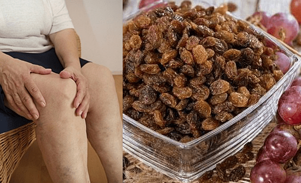 MNOGIMA JE POMOGLO – ISPROBAJTE: Za samo 1 mjesec, potpuno obnavlja kosti, tetive, ligamente, zglobove!