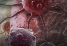 Dvije namirnice ubrzavaju starenje i podstiču rak: Izbjegavajte ih nakon 40. godine