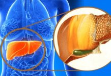 BOLESNA JETRA VAS UPOZORAVA SA OVIH 8 SIMPTOMA: Ako uočite nešto od ovoga, IDITE ODMAH DOKTORU!