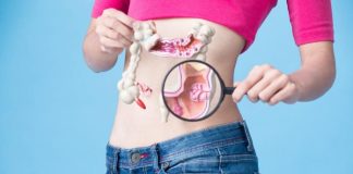 Mislila je da ulazi u menopauzu, a onda je saznala da ima rak debelog crijeva: to su bili prvi simptomi koje je osjetila