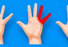 OBAVEZNO OBRATITE PAŽNJU: Ako vam trnu prsti, to može da znači nekoliko stvari, a ovo je uzrok