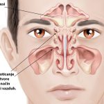 GODINAMA PROVJERENA METODA: Ovako čistite sinuse i uklanjate svu sluz iz nosa!