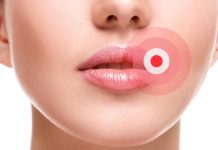 Ako ste ga ikada imali OVO u ustima, trebali bi znati šta je u pitanju, i kako da se toga riješite..