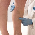 Prvi simptomi KRVNOG UGRUŠKA djeluju bezazleno – Ako imate OVE promjene na tijelu, ne smijete ih nikako ignorisati