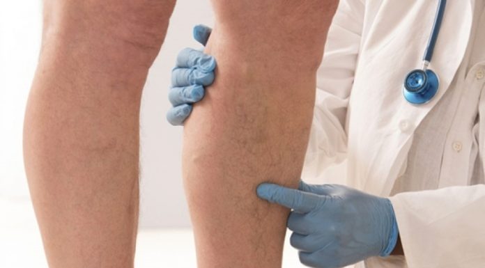 Prvi simptomi KRVNOG UGRUŠKA djeluju bezazleno – Ako imate OVE promjene na tijelu, ne smijete ih nikako ignorisati