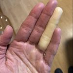 Ovo su posljedice spavanja sa…