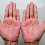 Mast koju svi treba da imamo kod kuće! Upotreba i savjeti