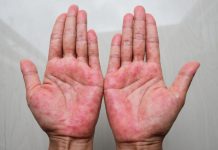 Mast koju svi treba da imamo kod kuće! Upotreba i savjeti