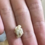 “Neočekivano i šokantno iskustvo: Ono što je izašlo iz mog grla će vas ostaviti bez riječi 😳”