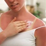 Izgorela je na suncu, a ovo ju je spasilo za 30 minuta: Svi to imamo u kući, a nije jogurt