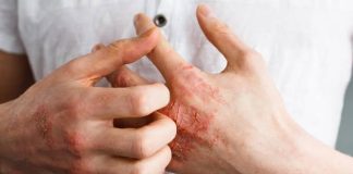 Umor, svrab, VISOK KRVNI PRITISAK, BOL U LEĐIMA – Ova bolest je ”TIHI UBICA”, obratite pažnju ako imate neke od ovih simptoma