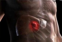 RAK JETRE IMA VE0MA PEP0ZNATLJIVE SIMPTOME – NE SMIJETE DOZVOLITI DA VAM PROMAKNU: Ovo su 4 faze razvoja OPAKOG tumora!