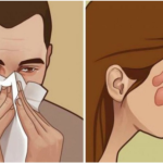 Budite se zapušenog nosa, a nije prehlada niti alergija? EVO ŠTA JE PROBLEM