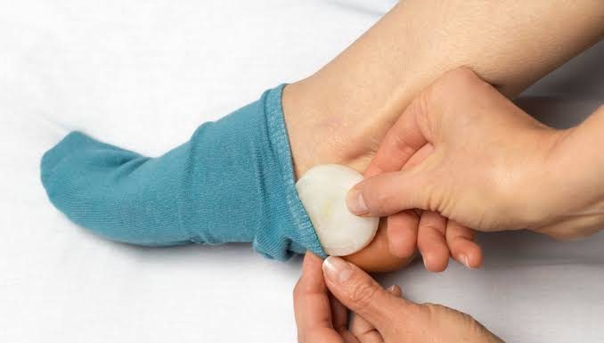 Stavite crni i bijeli luk u čarape i prespavajte u njima: Preporodiće vam tijelo, pogledajte i kako
